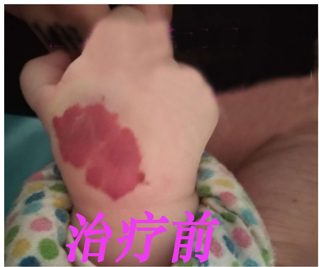 0001治疗前.jpg