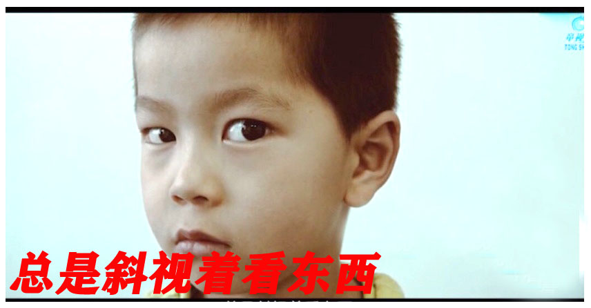 000001用总是斜视着看东西.jpg