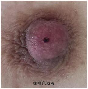 乳腺科图片.jpg