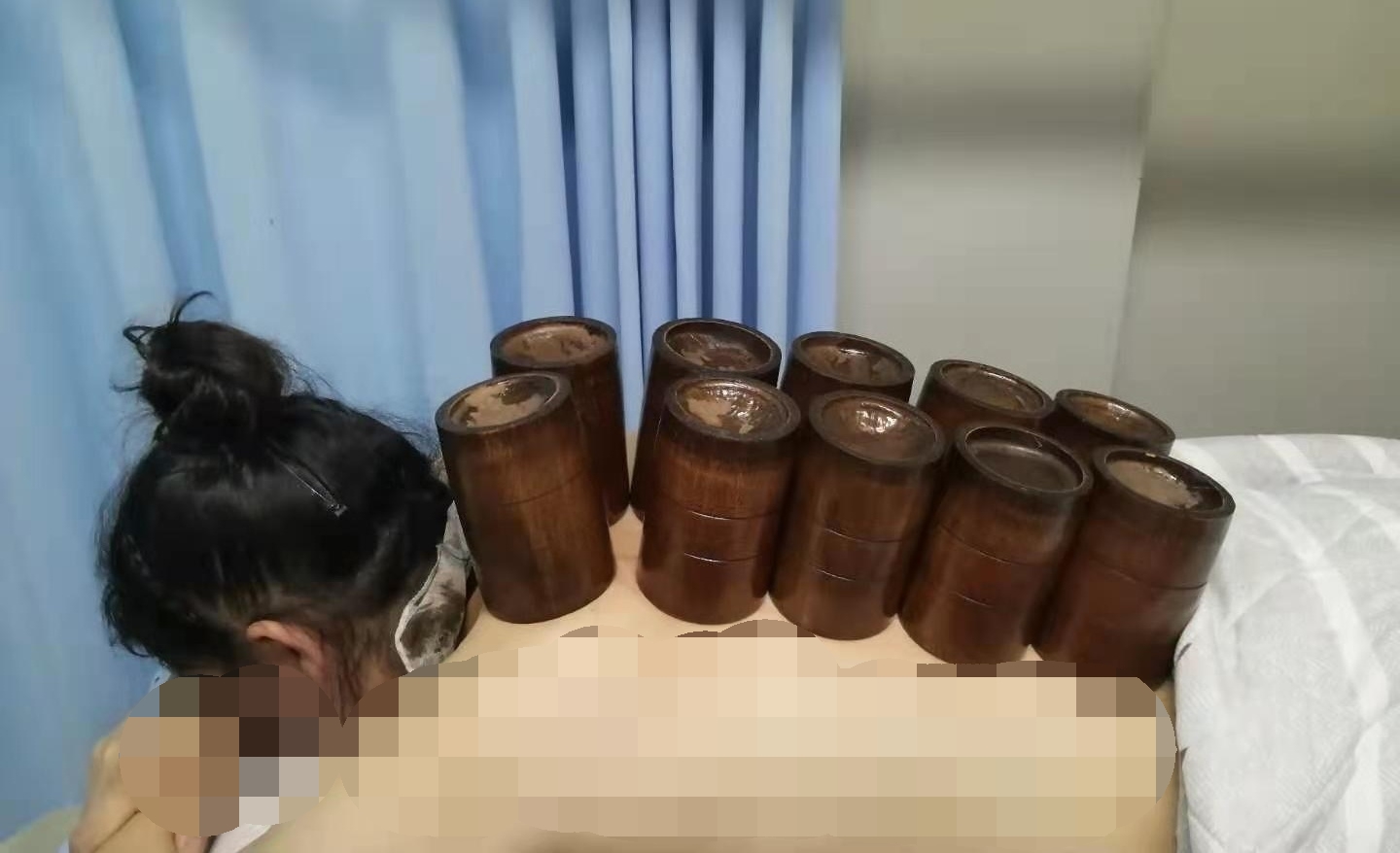 9拔罐.jpg