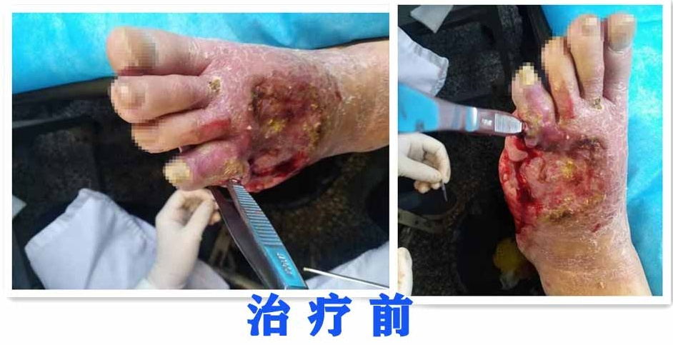 000001用用用治疗前拼图副本_看图王_看图王.jpg