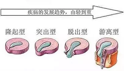 骨三图5.png