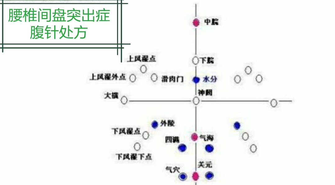 004腰椎图.jpg
