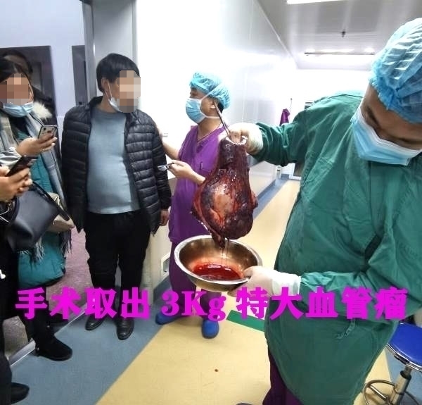 4血管瘤副本_看图王.jpg